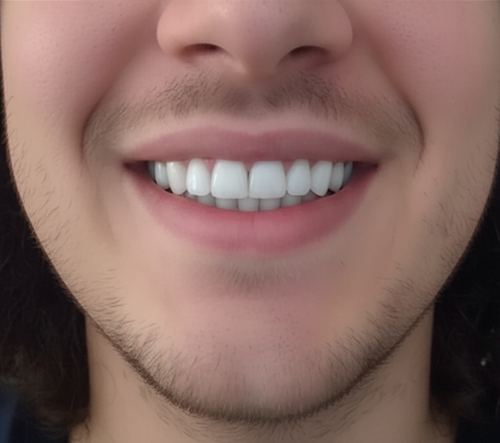 After