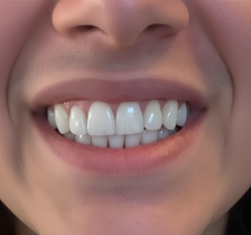After