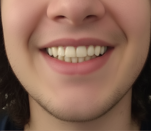 Before